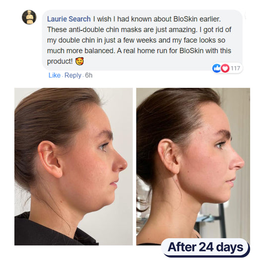 The BloSkin™ Lift : Say goodbye to your double chin now