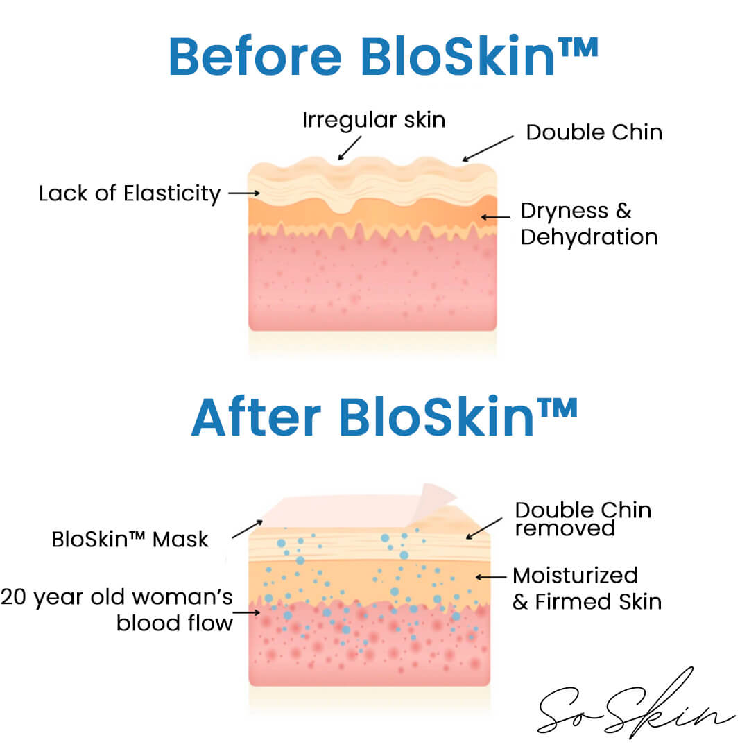 The BloSkin™ Lift - 17.90$